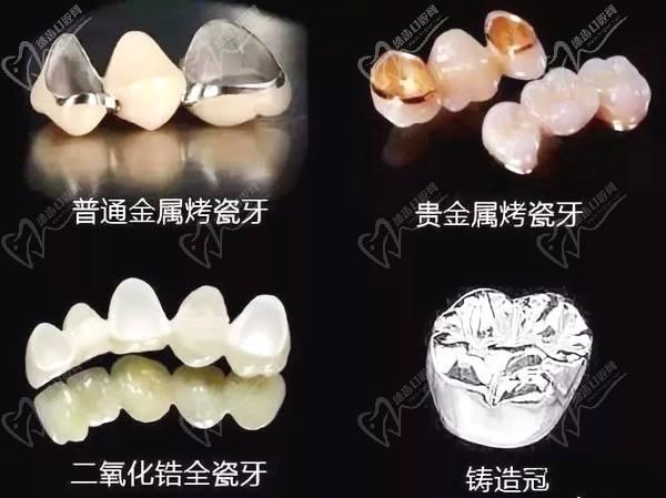 常德美奧口腔鉅惠看牙,韓國登騰種植牙3980元起,自鎖托槽矯正享5折優惠！